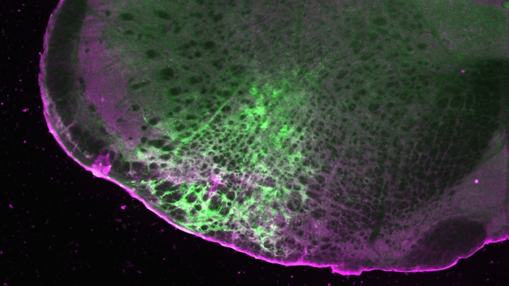 Fluorescent microscopy image of a slice of the mouse brainstem showing the detection of morphine