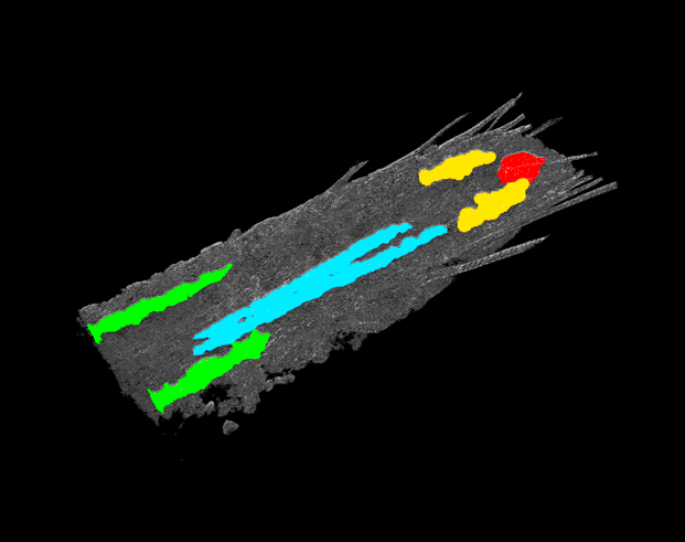 Regions of the Drosophila central nervous system that are activated in response to noxious stimulation