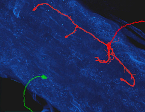 Axons in development
