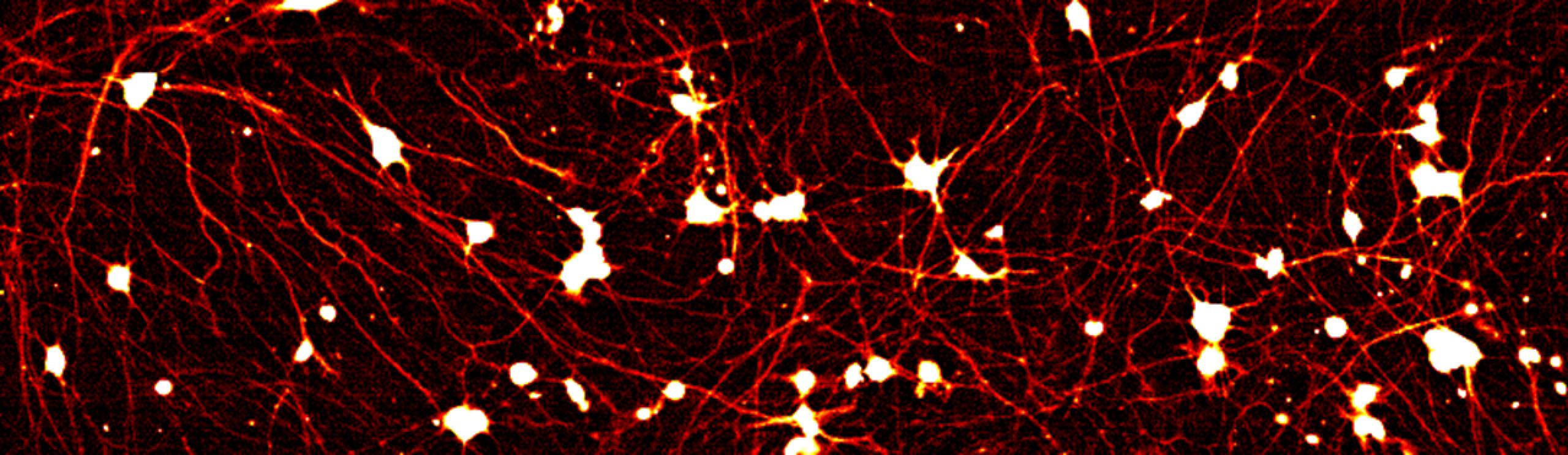 Day 14 human neurons differentiated from induced pluripotent stem cells (iPSCs) expressing Dendra2 driven by the native GAPDH promoter.