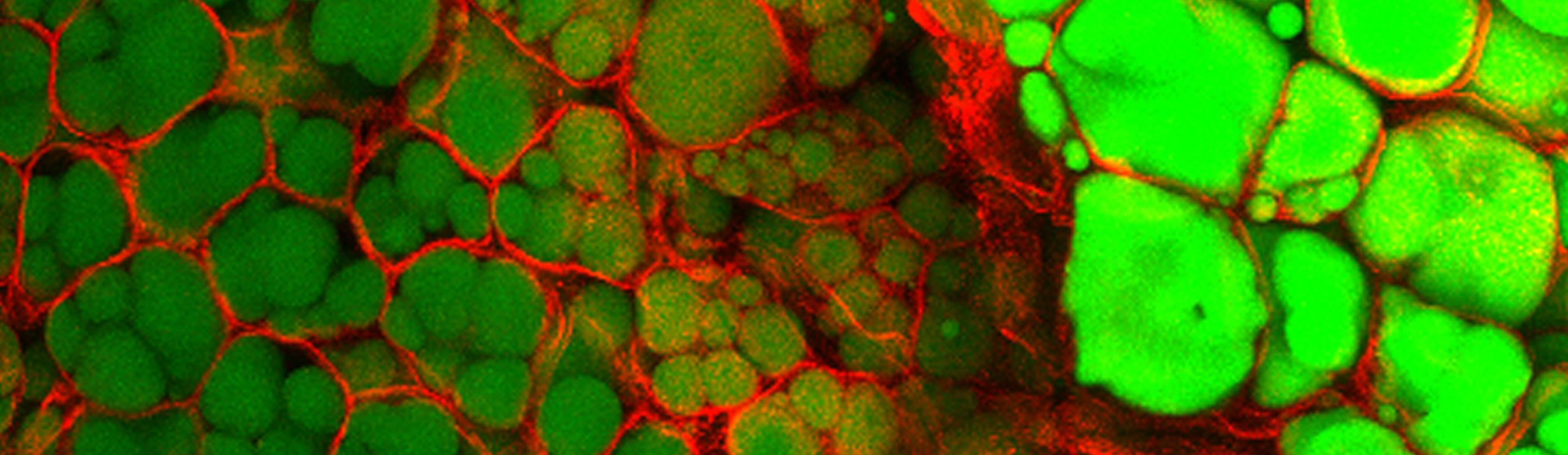 colorful fat cells