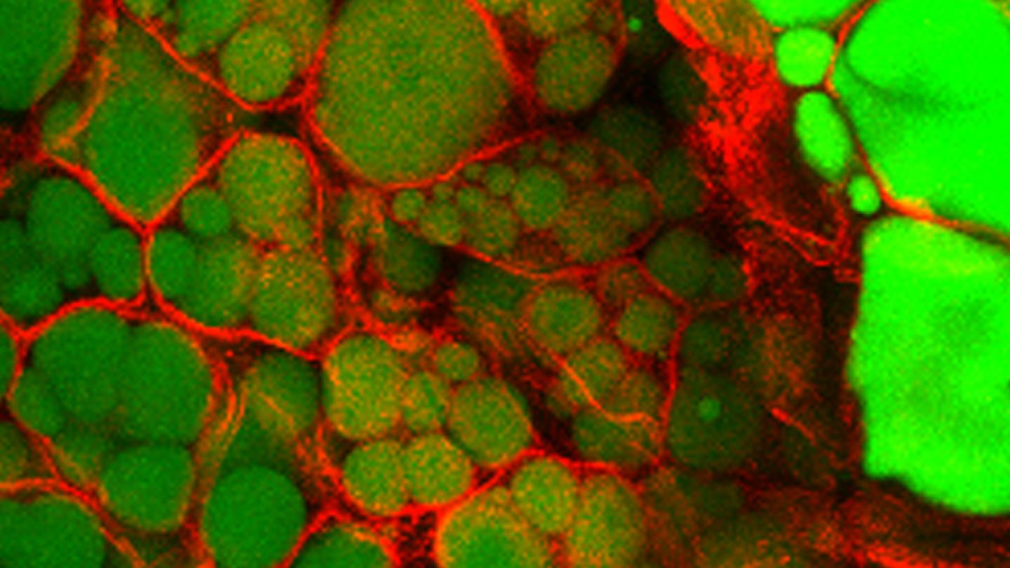 colorful fat cells
