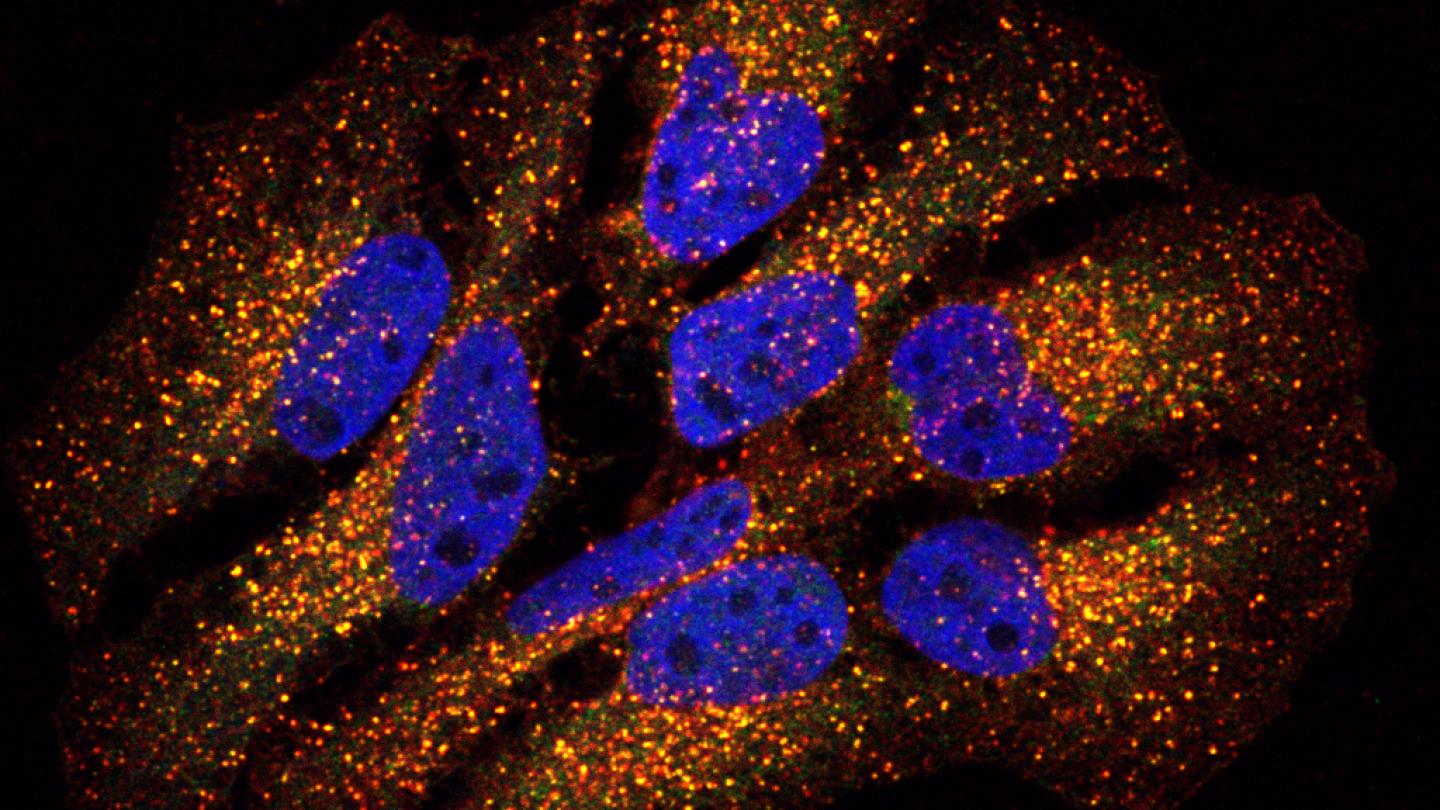  Wild type HeLa cells immunostained with antibodies against COMMD1 and VPS35