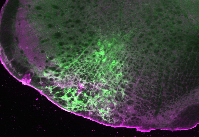 Fluorescent microscopy image of a slice of the mouse brainstem showing the detection of morphine