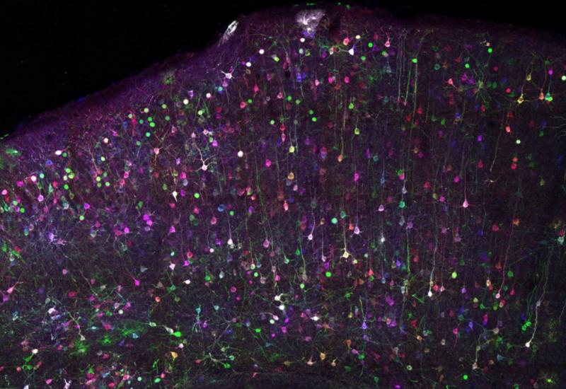Imaging of mouse cortex
