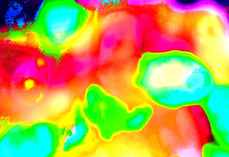 Heat map of thermogenic fat cells (artistic rendering)