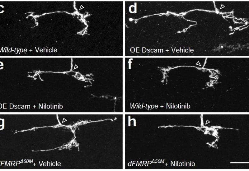 Neuronal overgrowth in Down syndrome model