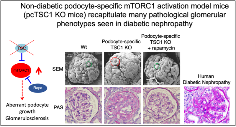 Scientific figure illustrating non-diabetic podocyte-specific mTORC1 activation